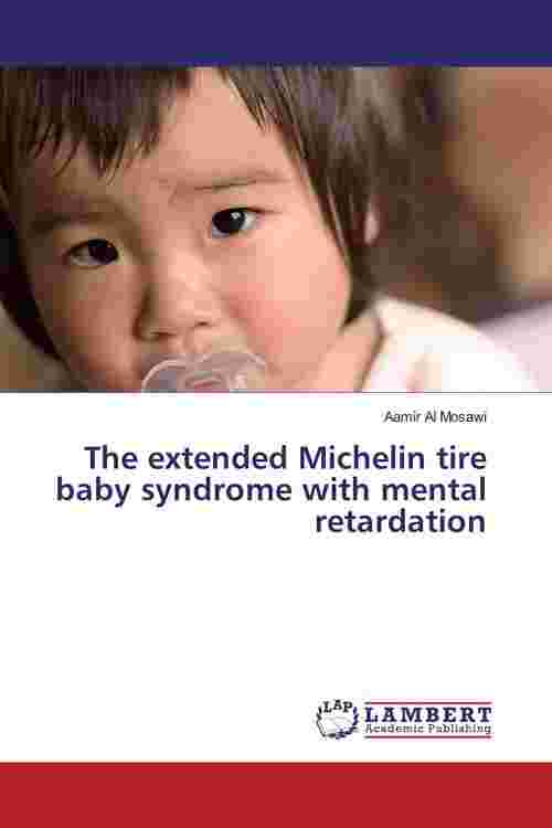 [PDF] The extended Michelin tire baby syndrome with mental retardation ...