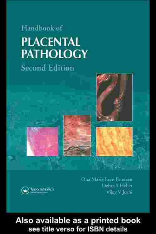 [PDF] Handbook of Placental Pathology by Ona Marie Faye-Petersen eBook